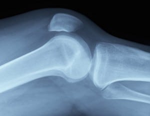 radiografia ginocchio fisioterapia roma boccea